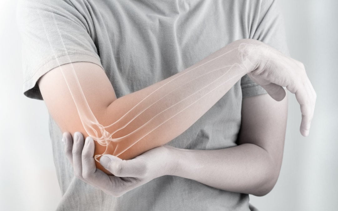 DePuy Synthes Elbow Implant Lawsuit