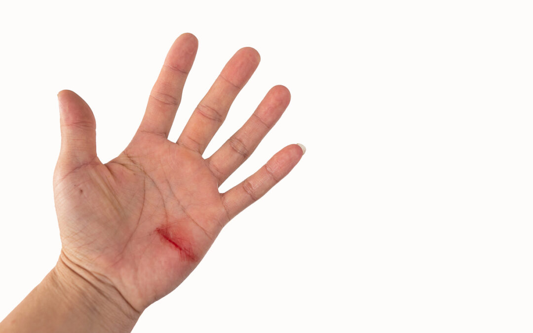 IKEA Glass Table Injury Lawsuit