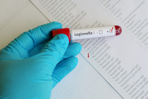 Cruise Ship Legionnaires' Disease Lawsuit | Lawyer, Attorney