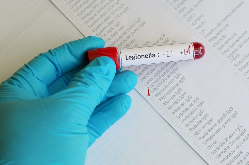 Cruise Ship Legionnaires' Disease Lawsuit | Lawyer, Attorney