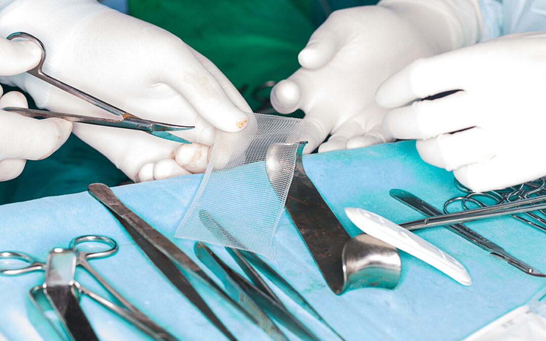 Abdominal Surgical Mesh Lawsuit