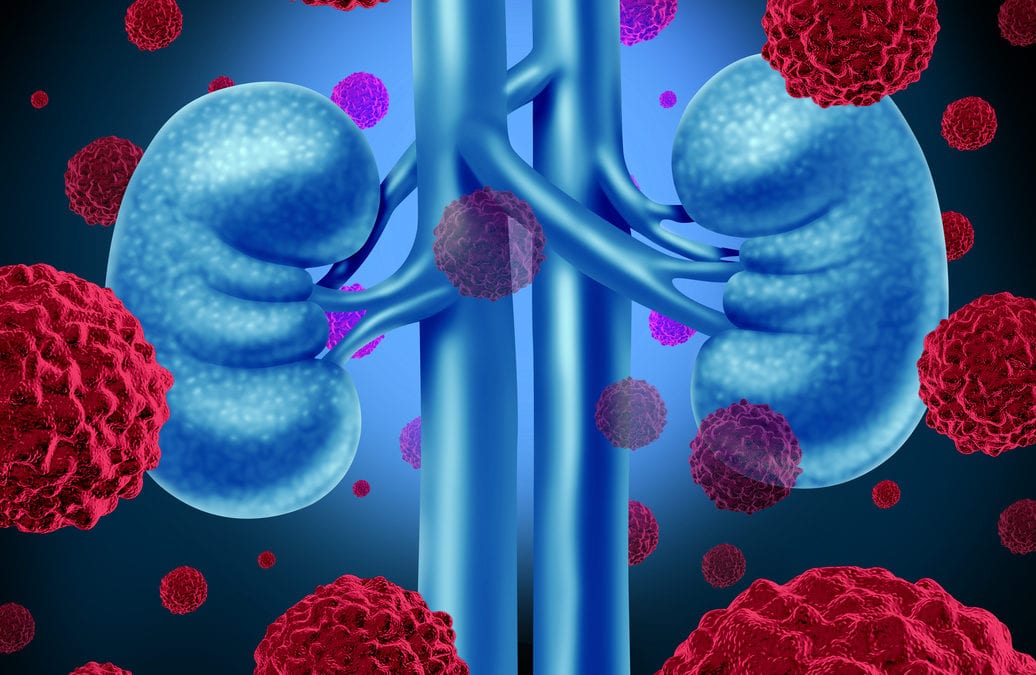 Invokana Kidney Cancer Lawsuit