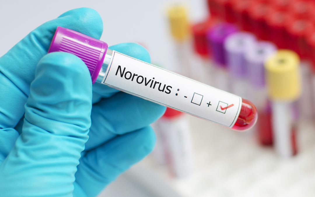 Arby’s Norovirus Lawsuit