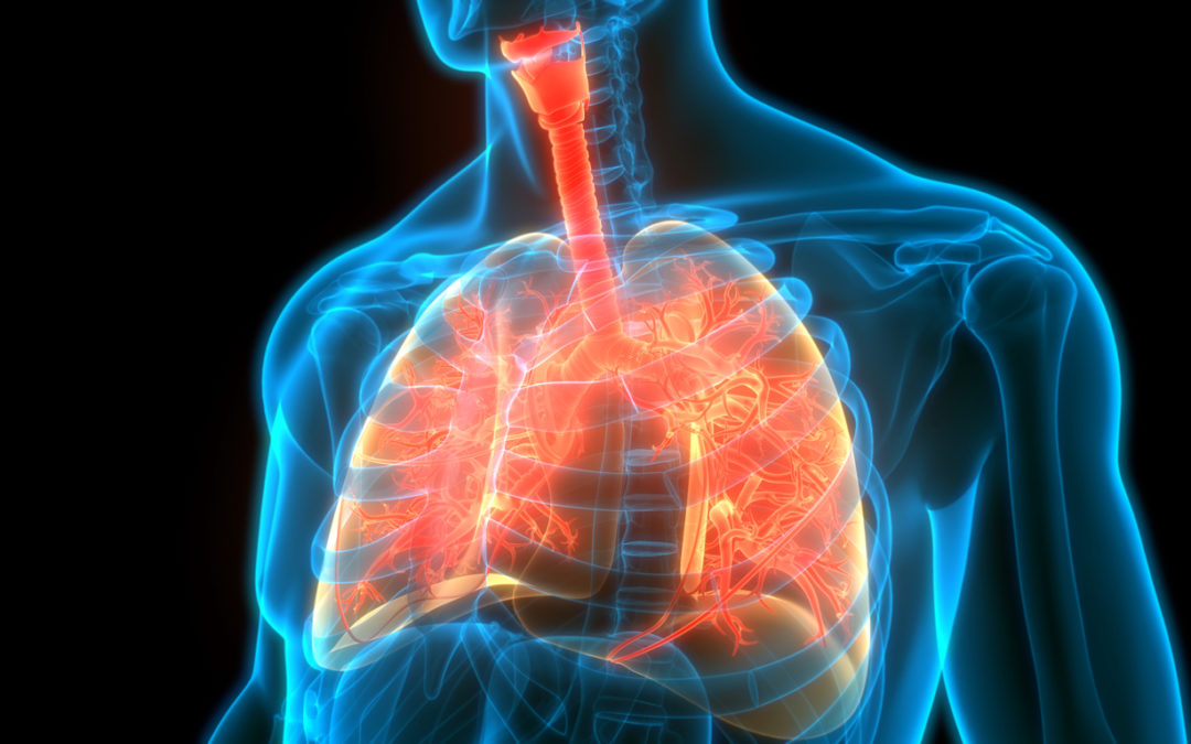 Pulmonary Fibrosis Lawsuit