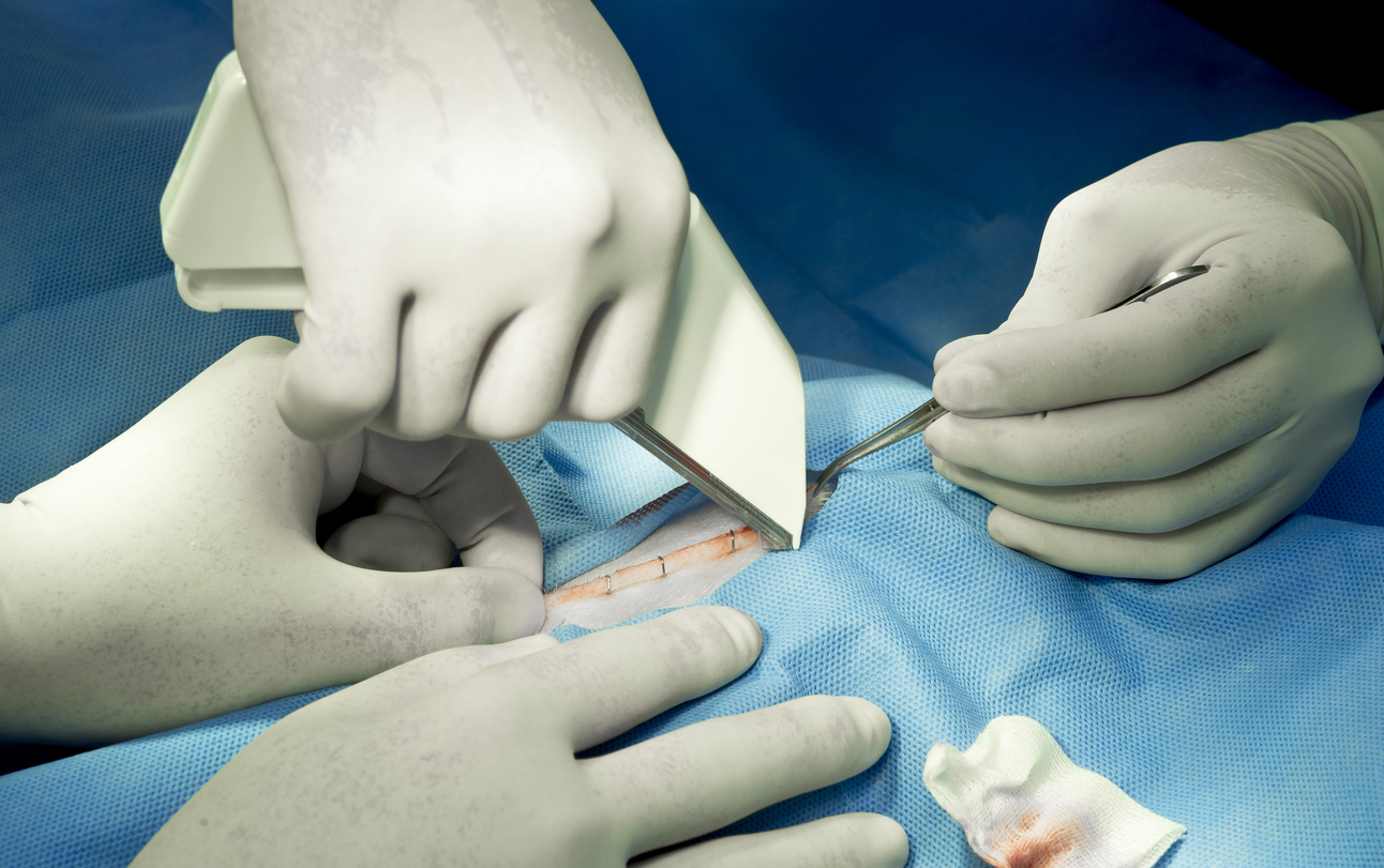 ethicon lawsuit staples