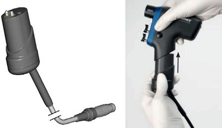 DePuy Synthes SBD Adaptor Lawsuit